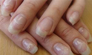 Как восстановить ногти после гель лака?